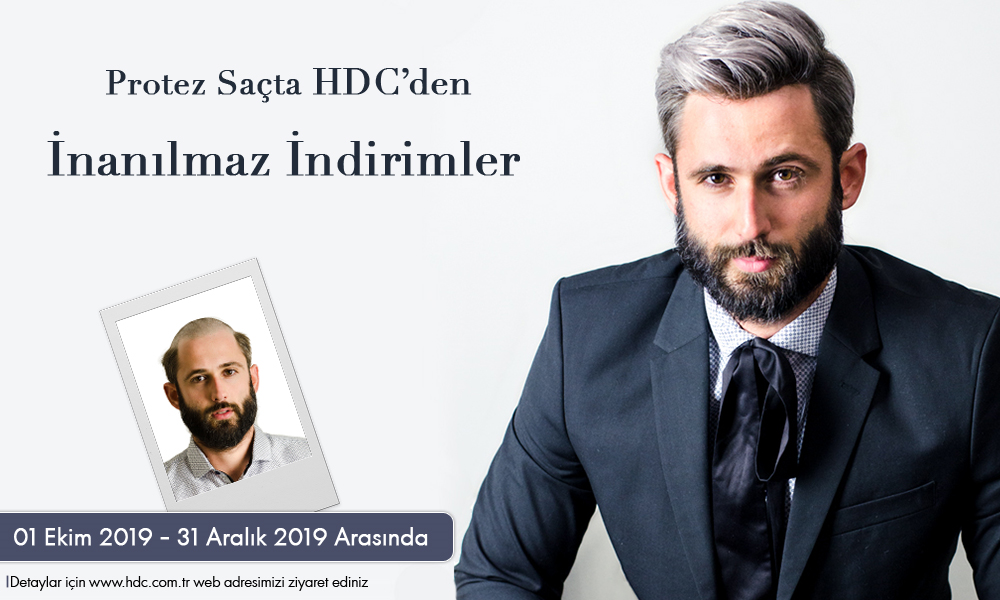 son teknoloji protez sac sistemi hdc protez sac merkezi turkiye nin ilk protez sac merkezi