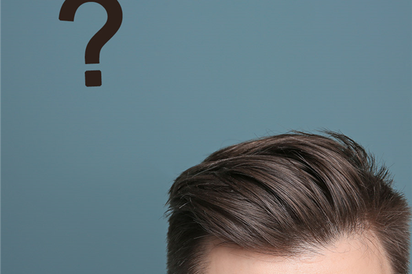 Protez Saç Nasıl Yapılır, Ne Kadar Sürer?