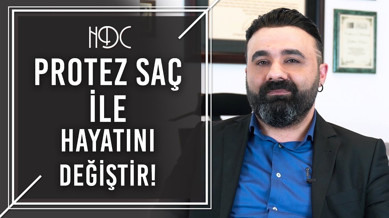 Protez Saç İle Yeni Hayata Merhaba - Emrah Sarıgöl