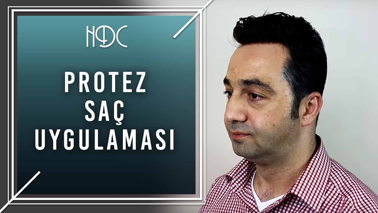 Protez Saç Uygulaması