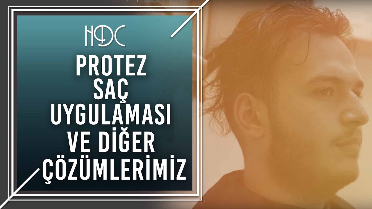 HDC Çözümleri